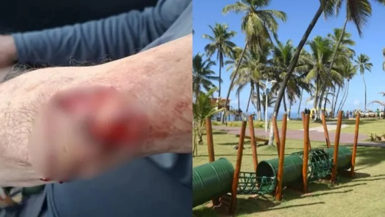 Idoso sofre ataque bruta de pitbull em orla movimentada de Salvador
