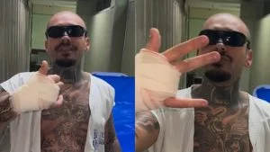 Streamer tem dedo amputado ao tentar invadir Rock in Rio e surpreende ao revelar que irá leiloá lo