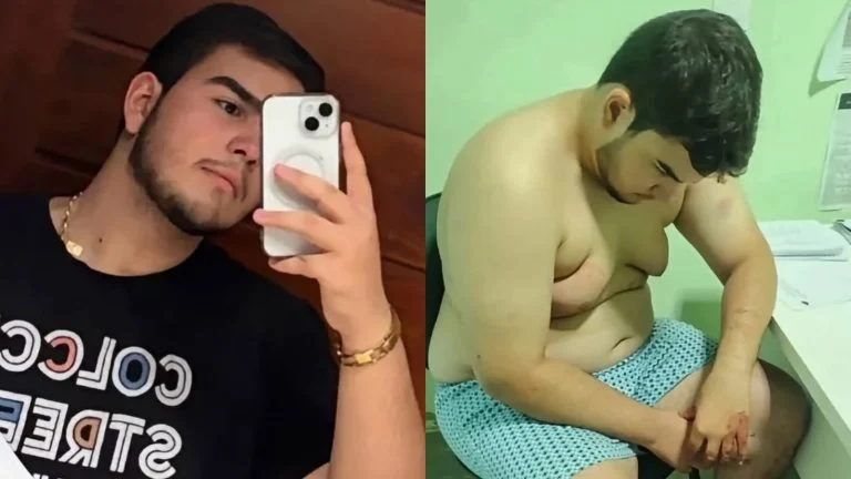 Jovem corta garganta da namorada após ela comemorar vitória de Lula nas eleições